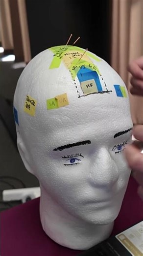 How to Needle Upper Limb Zone