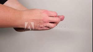 Woman rubbing and scratching her sole with her finger. Itchy red wounds on female foot after several confluent blisters of eczema. Acute psoriasis, allergic reaction, dermatological disease on foot.