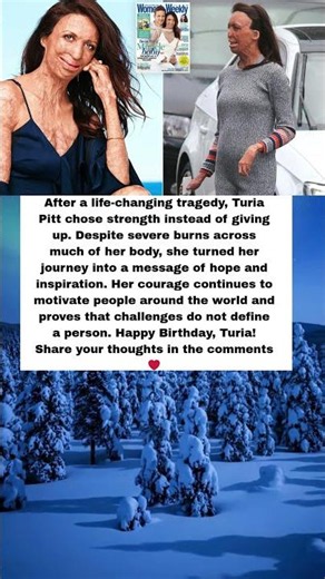 She Survived the Fire… Then Inspired the World ❤️🔥