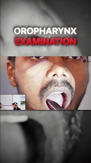 The VERY First Step of Oral Exam | Halitosis Explained | ENT & Dentistry #ClinicalSkills #Dentistry