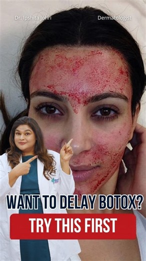 This Skin Treatment Uses Your Own Blood!🩸 #skincare #aesthetic #skin
