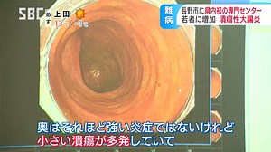 安倍元総理も患った「潰瘍性大腸炎」自分の意思に関係なく便意が…若者中心に毎年1万人ずつ増えているとも言われる難病の高校3年生が出会ったのは…？潰瘍性大腸炎とクローン病に特化した最新施設の治療 | TBS NEWS DIG