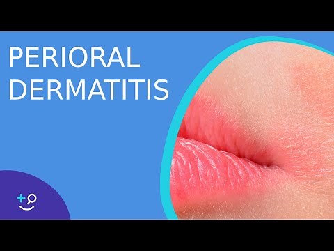 Perioral Dermatitis - Daily Do's of Dermatology