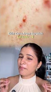 Why acne and pimples come on face, Learn skincare from Scratch EP-6 #skincare #acnecare