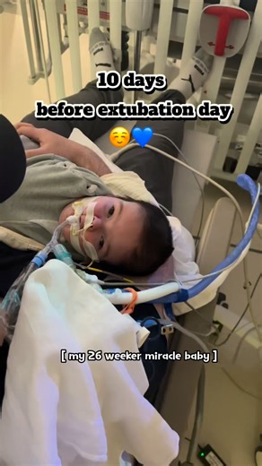 HAPPY ANNIVERSARY !!! It’s been a year since Matthew extubated … he was intubated since he was born up to almost a year !!! Last year when we tried the 1st extubation trial !!! He’s been through a lot since he was born and mama as well !!! [ his family ] !!! It was a roller coaster journey but with all your prayers things are getting and getting better 🙏🙏💙💙🥺🥺 | Rose & Tisoy Kids