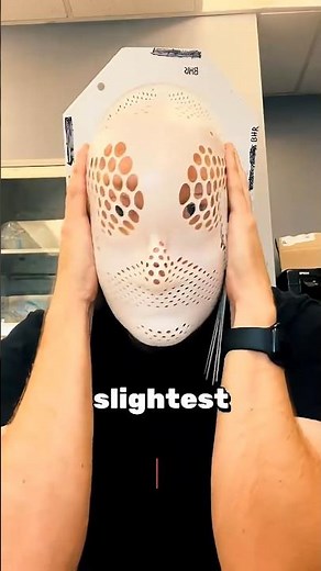 Why This Radiotherapy Mask Keeps Patients Completely Still During Treatment 🏥🧠