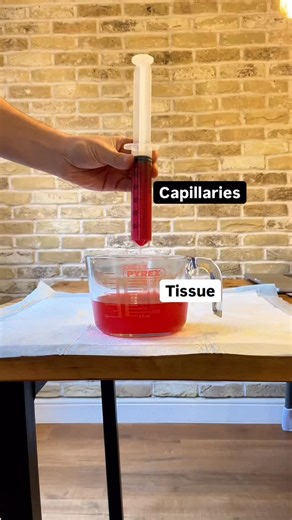 Why Low Albumin Causes Oedema (Push vs Pull) If you want to smash trauma in 30 days comment “trauma” & receive a free 60 page trauma eBook at the end Low albumin = reduced oncotic “pull”. So hydrostatic “push” wins… and fluid shifts into tissues. That’s pitting ankles, sacral oedema, and sometimes ascites. Learn. Adapt. Respond. | The Medical Lounge