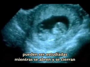El Aborto : El Grito Silencioso 1
