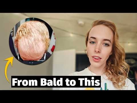 My Hair Regrowth Story MTF, HRT, and What Actually Worked