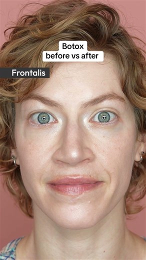 This is what a targeted preventative and corrective treatment looks like. 💉