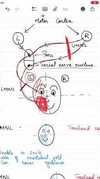 Facial Palsy Types - UMNL & LMNL (Bells palsy and Central palsy difference) #palsy #facialparalysis