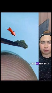 Nail dust under a microscope #microscope #naildust #bacteria #germs #reelfacebook #reelsfacebookviral #fbpostviral #everyonehighlightsfollowers #everyonehighlights #everyoneactive #highlights | Ricky Limulong