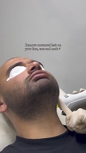"Now I have tiny red bumps all over my thighs." That’s what happens when laser treatments are too harsh — or wrong for your skin type. We do things differently. ✅ GentleMax Pro Plus is precise, not aggressive ✅ No burning, no follicle trauma ✅ Smoother skin, reduced bumps, less irritation Say goodbye to the itch, redness, and rough texture. Say hello to confidence. 📅 Your skin deserves better. Book your FREE consultation today. | Cleanskin Laser