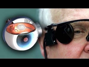 Bionic Eye Cures Blindness