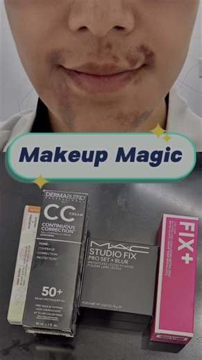 Elaine Kung, MD, FAAD | Makeup Magic 💫 Learned how to cover up my Sculptra injection bruises so I can share these tips with you 😉 Used @clinique peach color... | Instagram