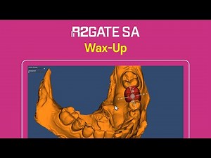 R2GATE SA Tutorial Series | Step 4: Digital Waxup🎬