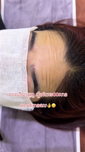 #ជ្រួញកន្ទុយភ្នែក #ជ្រួញថ្ងាស #khmertiktok #នាទីធ្លាក់like💔🙃 #phnompenhcity