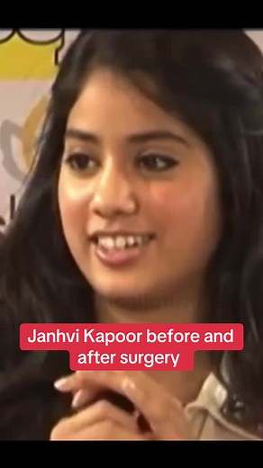 Janhvi Kapoor: Before and After Surgery Journey