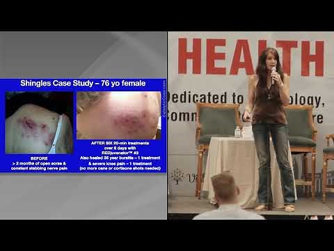 Science of Quantum RED Light Therapy for Skin, Pain, Eyes & more: REDjuvenator Medical Case Studies