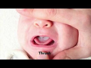 Physical Examination of a Pediatric Patient