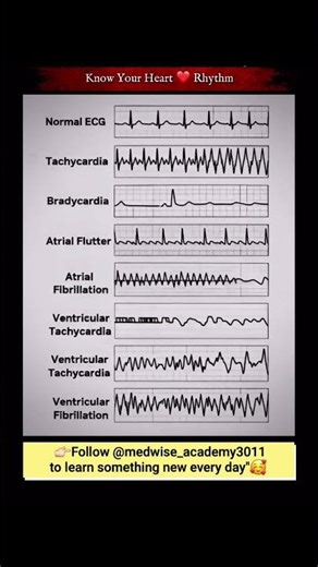 "ECG Patterns Explained" 😱