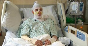 Uncle Endures Third-Degree Burns After Sprinting Into Blazing House To Save Life Of 8-Year-Old Niece