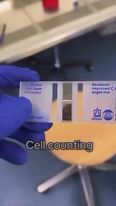98K views · 2.1K reactions | Cell counting  #microbiology #microbiologist #microbiologylab #explorepage #bacteriology #microbe #science #molecularbiology #kesfet #virology #pcr #cell #culture #media #molecular #lifescience #knowledge #know #fact #mikrobiyoloji #bacteria #bakteri #microbiologia #lab #laboratory #phd #phdstudent #fyp #viral #reel | Medical Microbiologist | Facebook