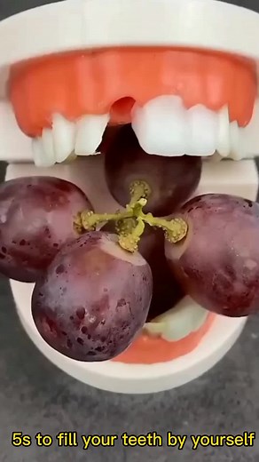 DIY Teeth Filling Material: Easy Steps and Tips