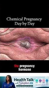 Positive Pregnancy Test… Then a Period? It Could Be a Chemical Pregnancy #pregnancy