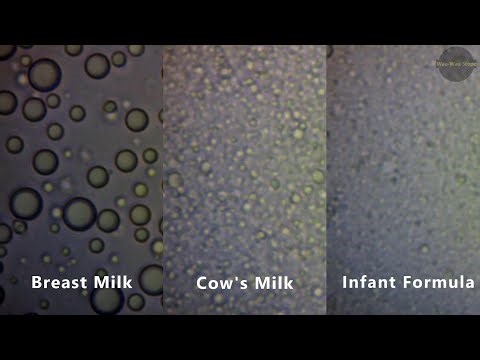 Relaxing Microscopic Exploration: Breast Milk vs. Infant Formula vs. Cow's Milk