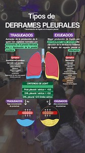 24K views · 572 reactions | 贈El derrame pleural puede ser...