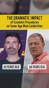 The Dramatic Impact of Cosmetic Procedures on Same-Age Male Celebrities | Bright Side of Love