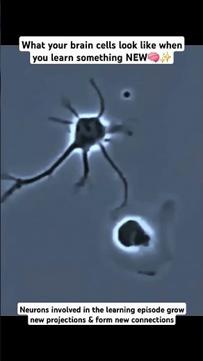 This is how your brain cells act when you learn something new #shorts #neuroscience #neuroplasticity