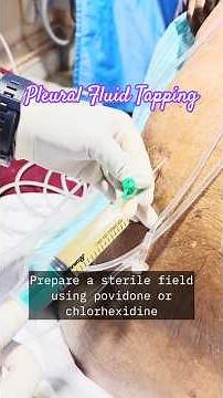 “Pleural Fluid Tapping (Thoracocentesis) | Step-by-Step Procedure & Safety Tips”