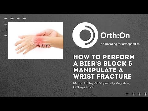 How to Perform A Bier's Block