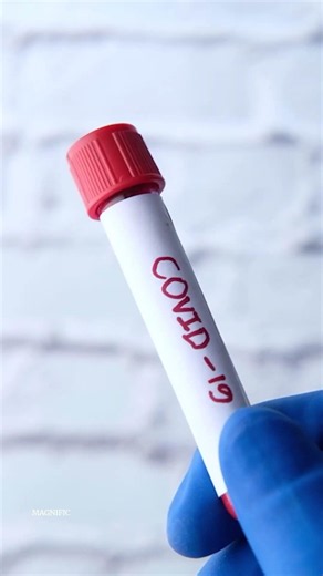 COVID-19 cases rise in CDMX