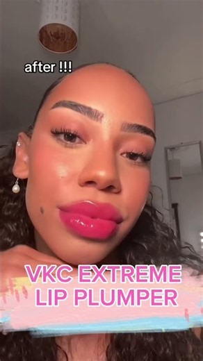VKC Extreme Lip Plumper Before & After 👄🔥 | Does It REALLY Work?!