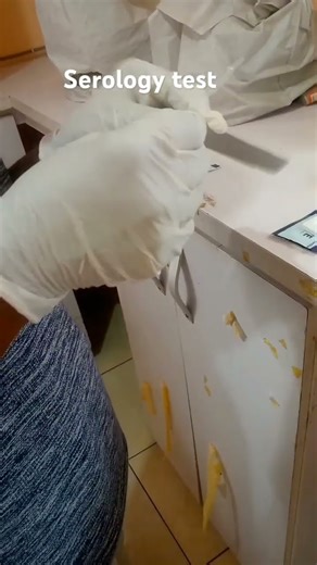 lab life #serology test#diagnosis..