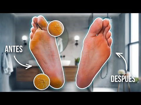 How to Remove Dryness and Calluses on Your Feet