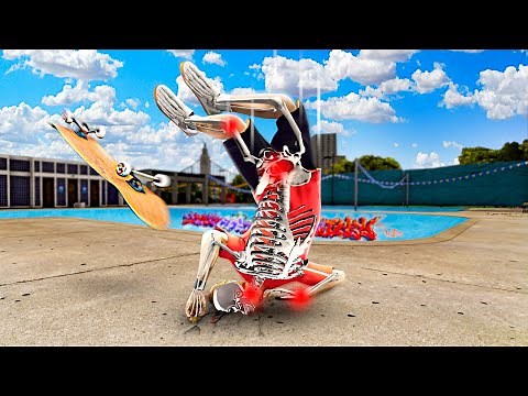 Breaking EVERY BONE As Skateboarder.. (HELP)