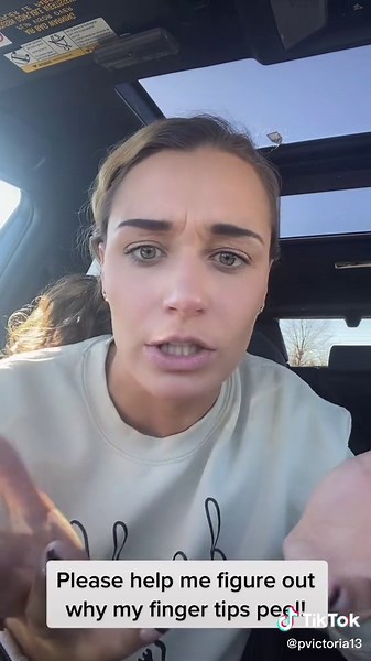 Understanding Finger Peeling: Causes and Remedies