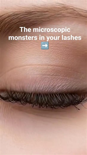 Eyelash Mites #bacteria #eyelashmite #themicrobevibes #shortsfeed #yt #ytshorts #trending #viral