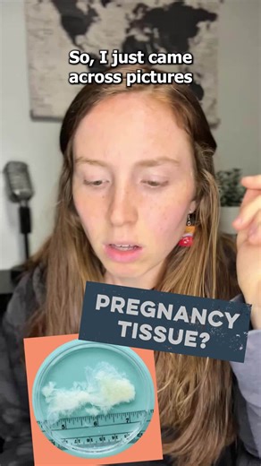 Don't be fooled by these pictures of "pregnancy tissue" put out by the MYA Network. They REMOVED the babies before taking those photos, and yet they use the photos to make people feel better about killing their preborn babies. Disgusting. #myanetwork #abortionvictims #misinformation | Created Equal