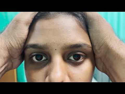 The Clinical Head Impulse Test Technique