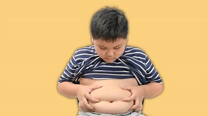 Reasons And Causes Of Childhood Obesity Explained By Doctor