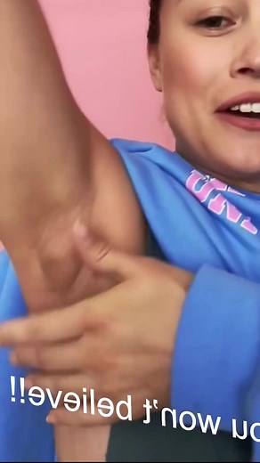 Squeezing giant blackheads and pimples 😱 #pimple #pimplepop #popping #extractions #blackhead #blackheadsremoval #infection #cyst #cystpopping #cystremoval #cystexplosion