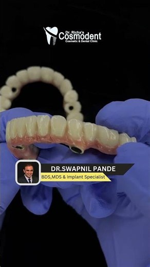 The DMLS Screw-Retained Prosthesis | Premium Implants at Affordable Costs
