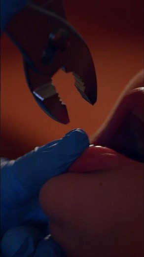 The Dentist | Horror Short Film #horrorshorts #acmofficial