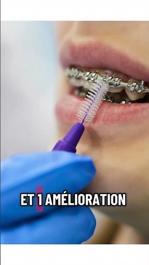 Le guide du nettoyage interdentaire Épisode 2 : les brossettes #dentist #conseilssante #dentalcare