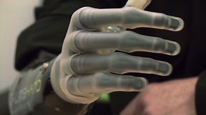 The bionic hand with the human touch | CNN Business